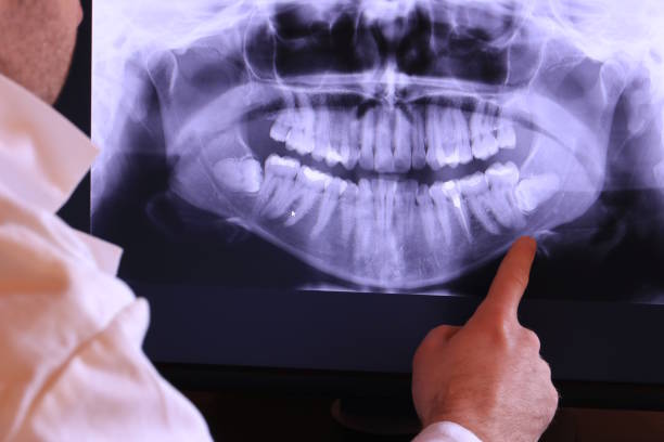Best Emergency Dental Surgery in New Union, TN