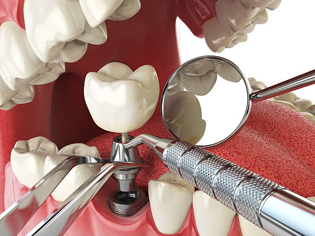 Best After-Hours Emergency Dentist in New Union, TN